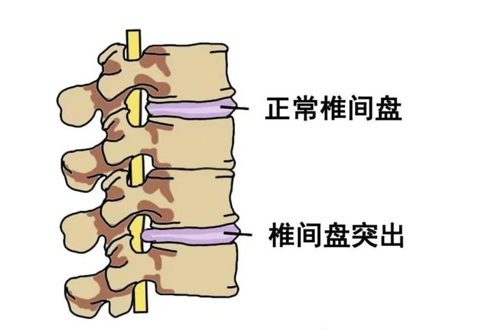 图片 2.png