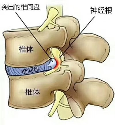 图片 1.png